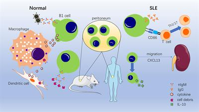 The Role of B1 Cells in Systemic Lupus Erythematosus